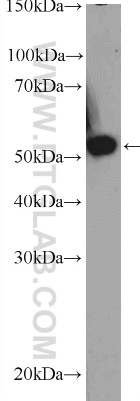 TBRG4 Polyclonal antibody