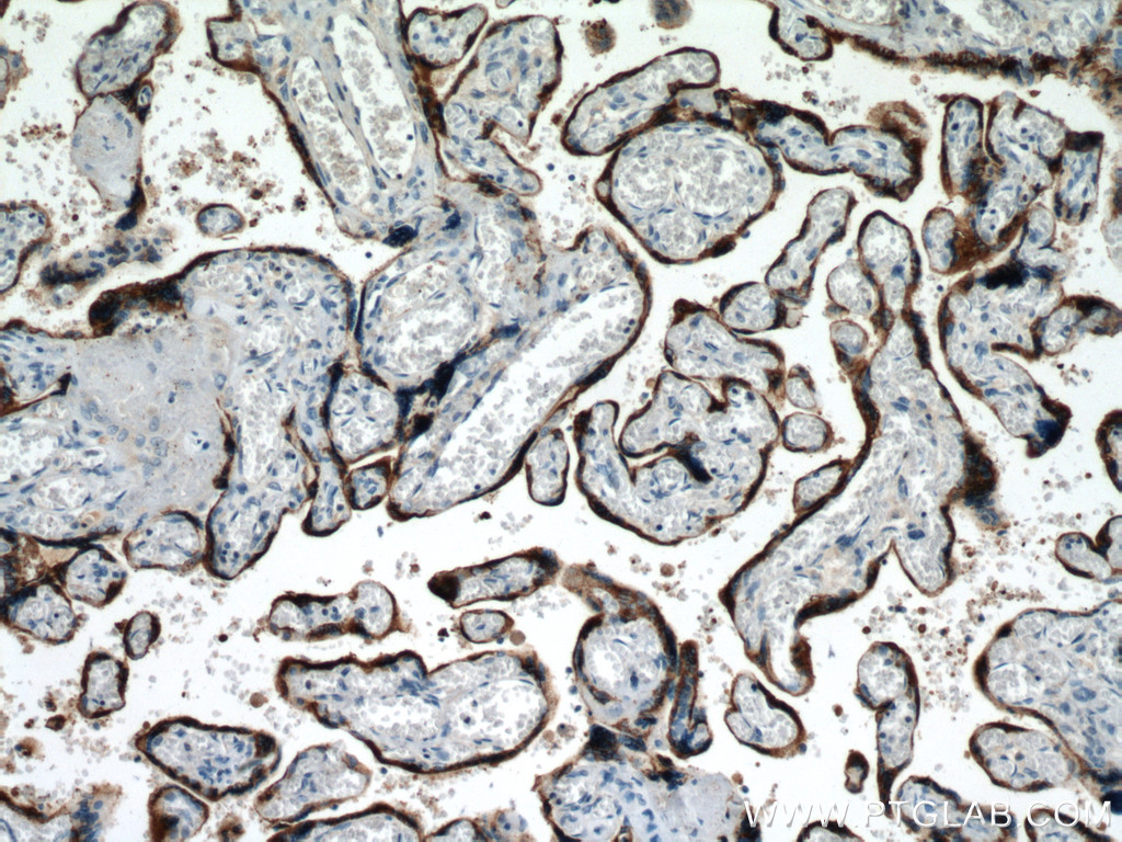 Placental lactogen Polyclonal antibody