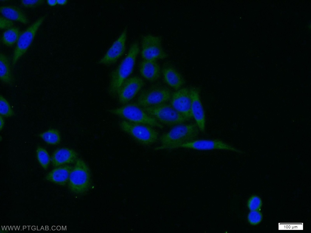 IGFBP3 Polyclonal antibody
