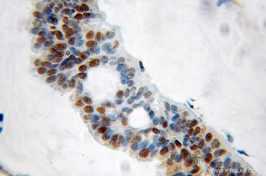 GNL2 Polyclonal antibody