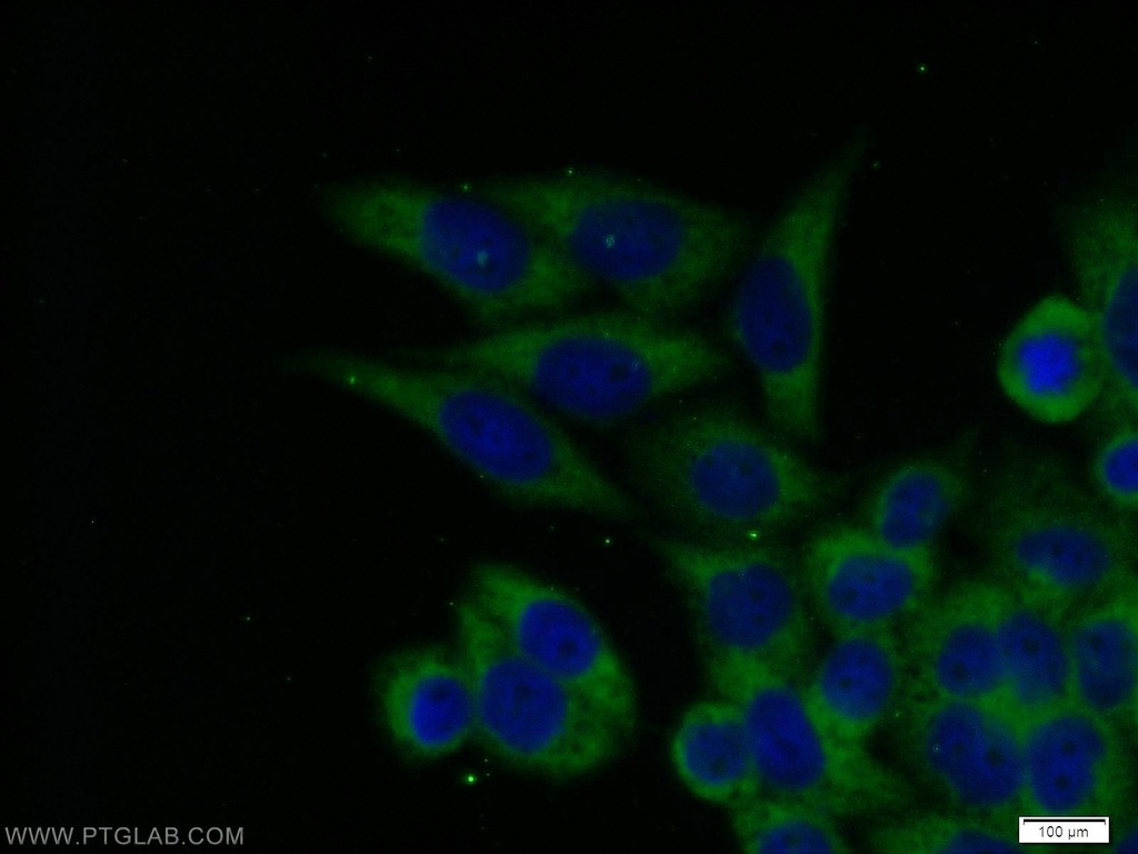 ECD Polyclonal antibody