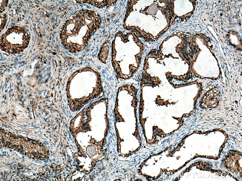 CAPG Polyclonal antibody