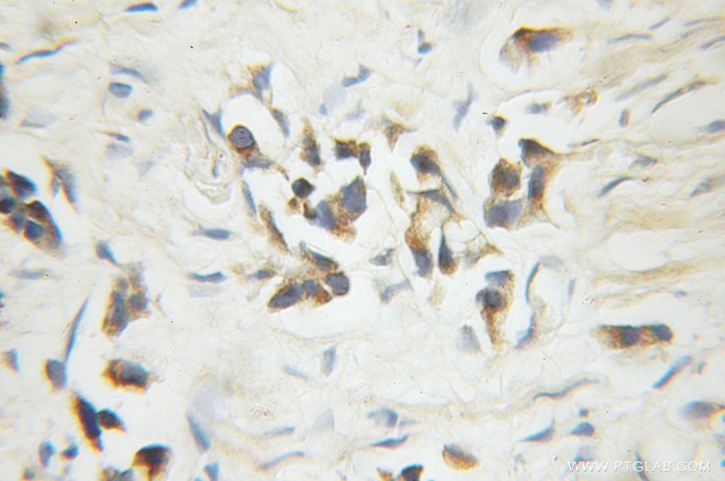 Caspase 6/p18/p11 Polyclonal antibody