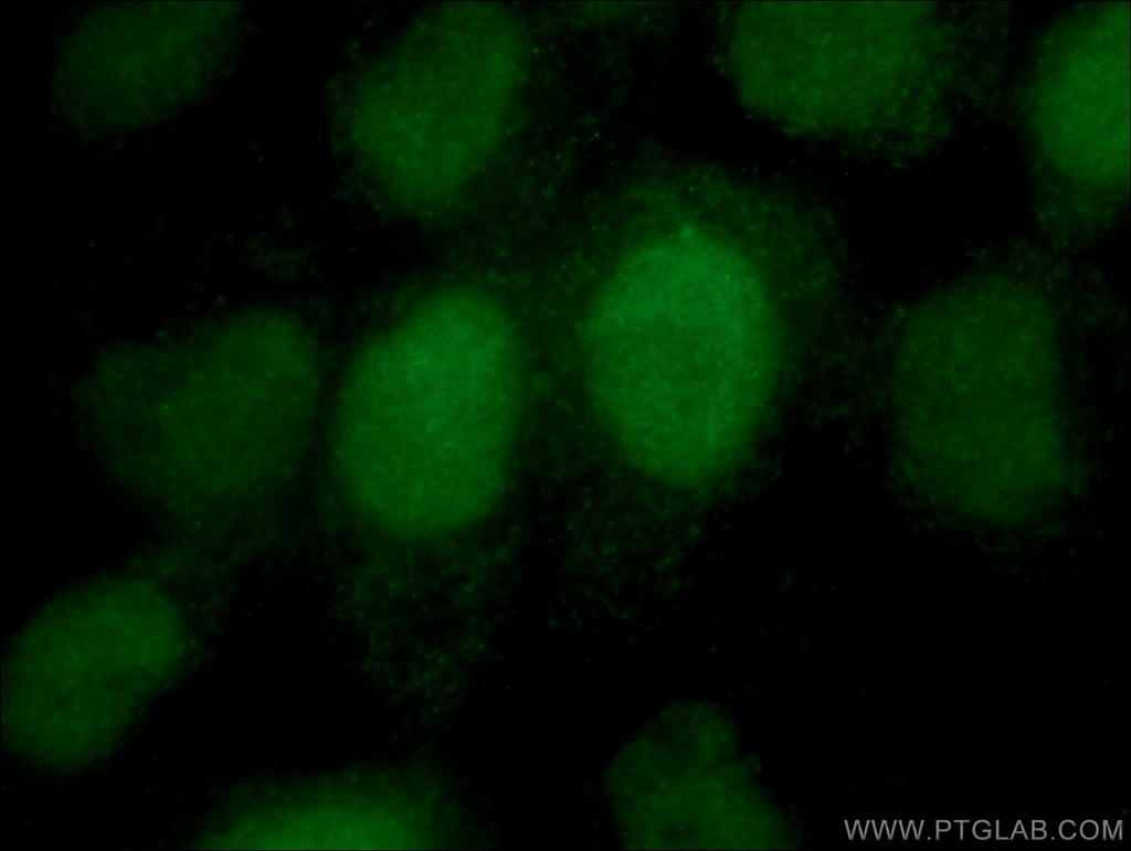 DUSP11 Polyclonal antibody