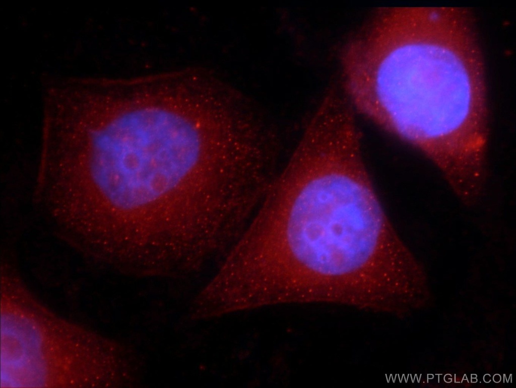 CIRBP Polyclonal antibody