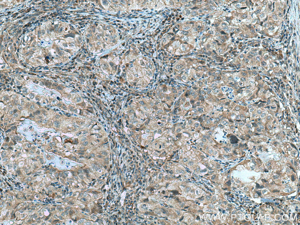 RABEPK/p40 Polyclonal antibody