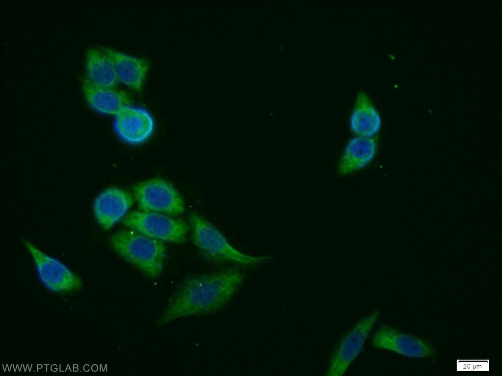 FANCG Polyclonal antibody