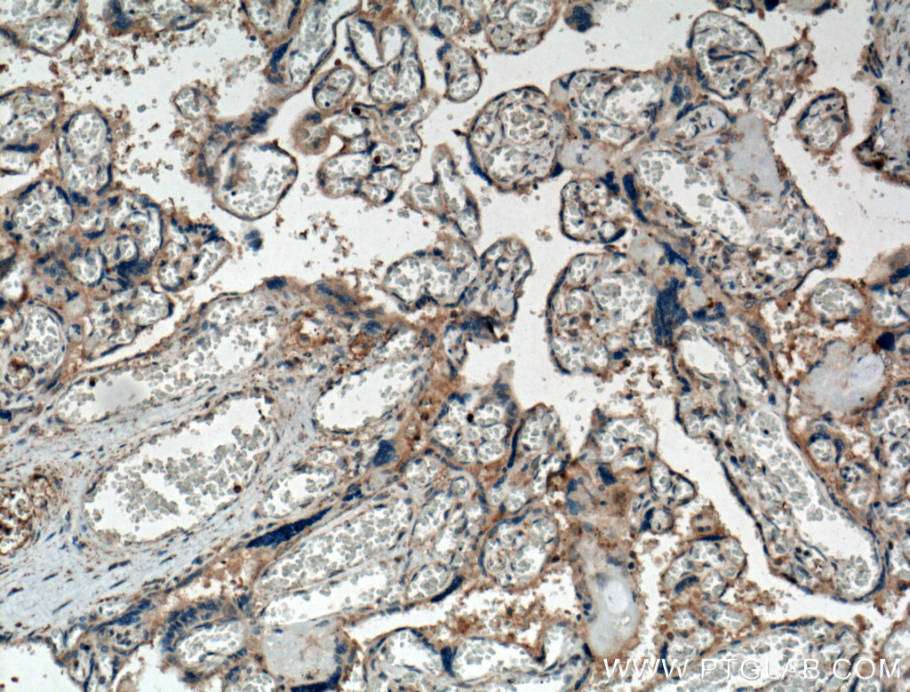 Chemerin Polyclonal antibody