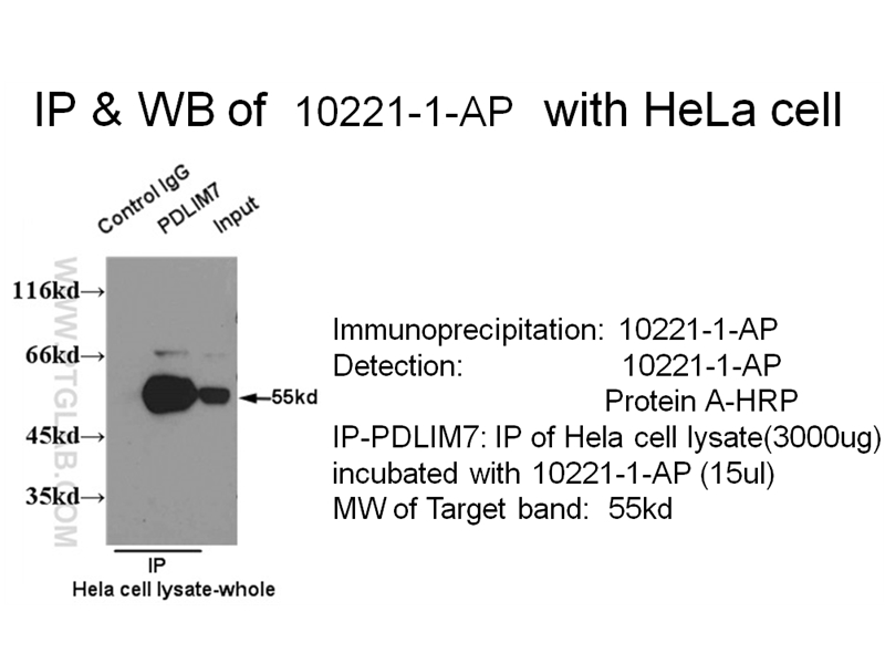 PDLIM7 Polyclonal antibody