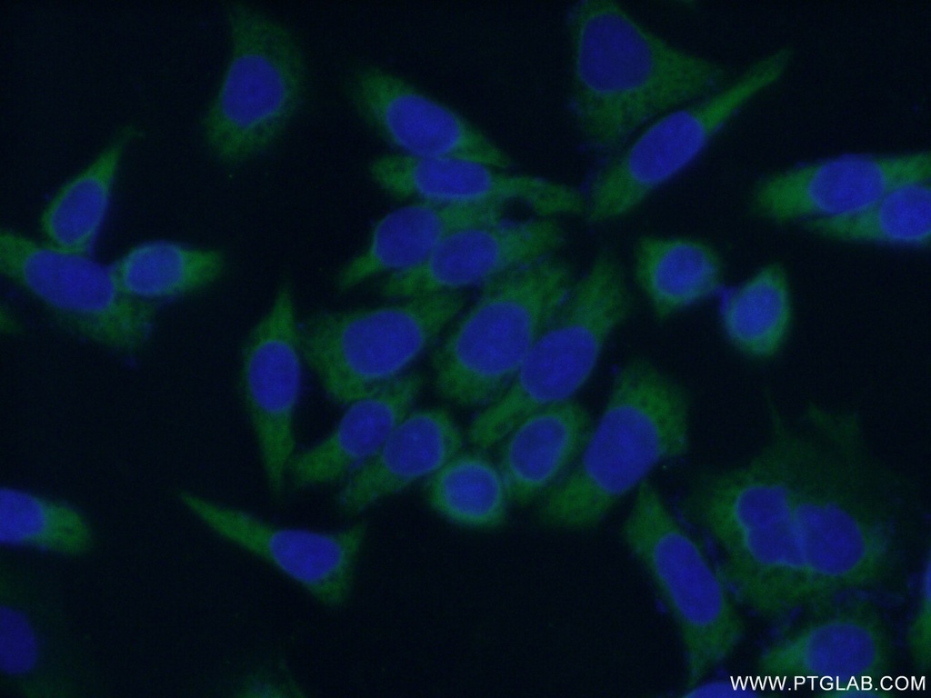 ABCF2 Polyclonal antibody