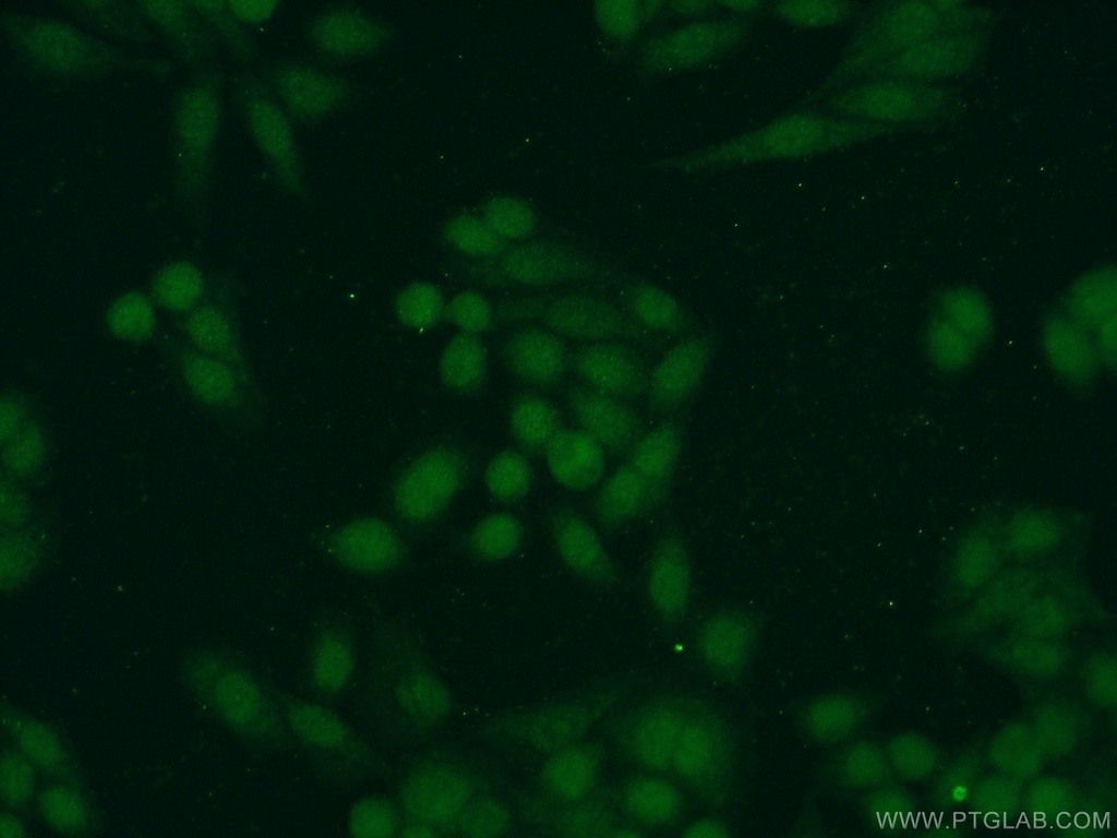 SAE1 Polyclonal antibody