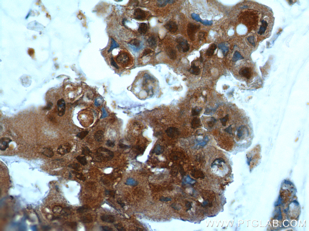 UBC13 Polyclonal antibody