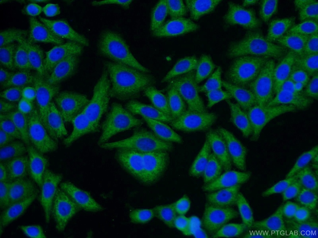 GNB1 Polyclonal antibody