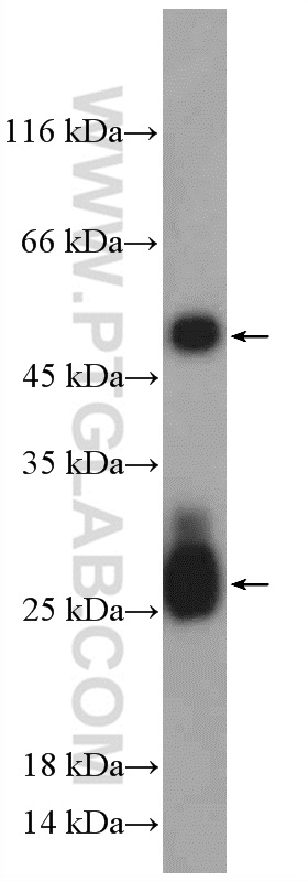 Mouse-IgG Polyclonal antibody