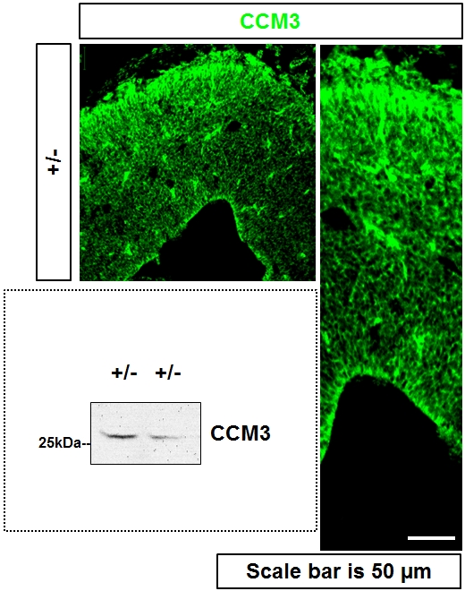 CCM3/PDCD10 Polyclonal antibody