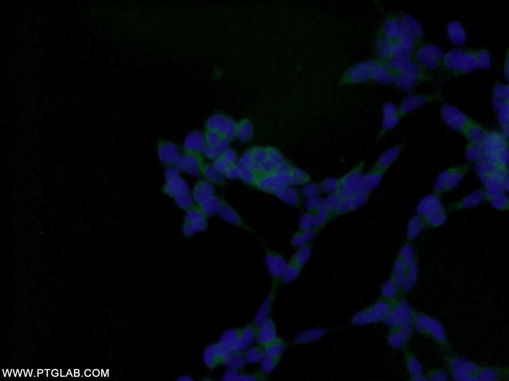 AMPK Beta 1 Polyclonal antibody