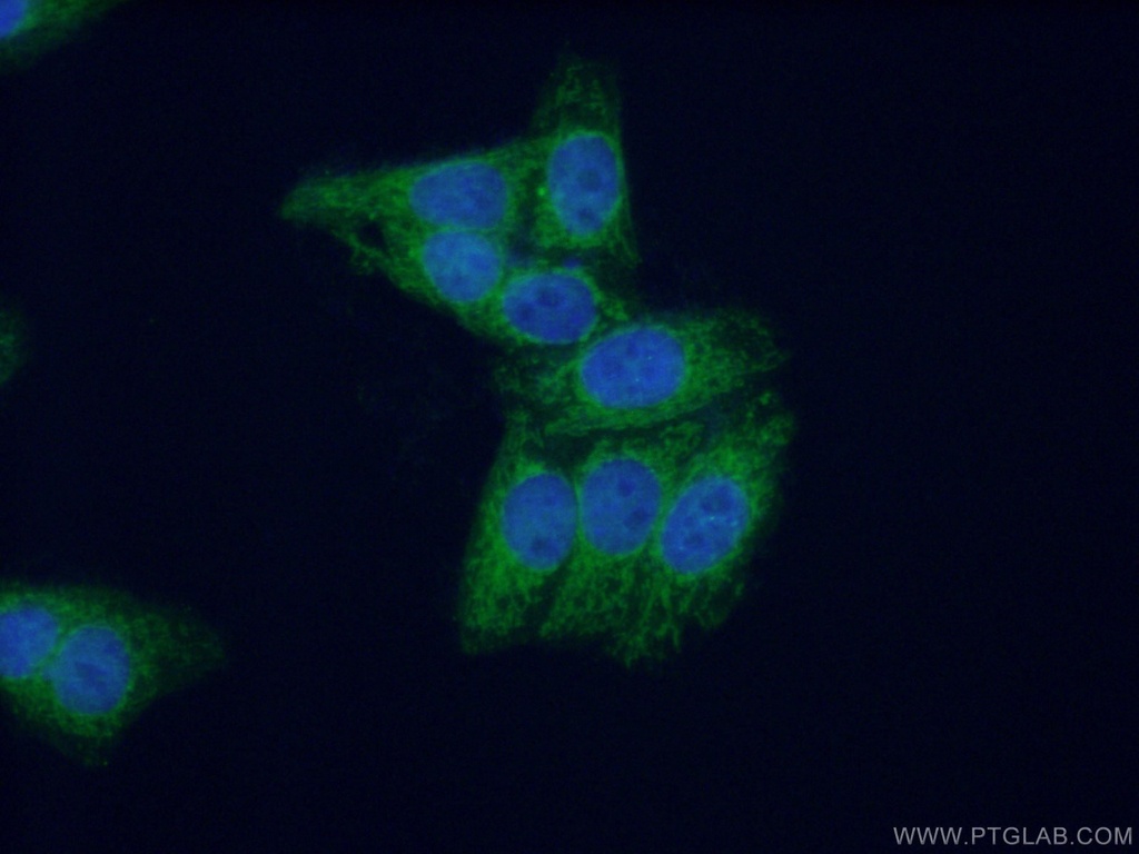 MPV17 Polyclonal antibody