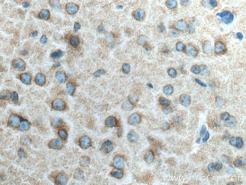 CRMP1 Polyclonal antibody