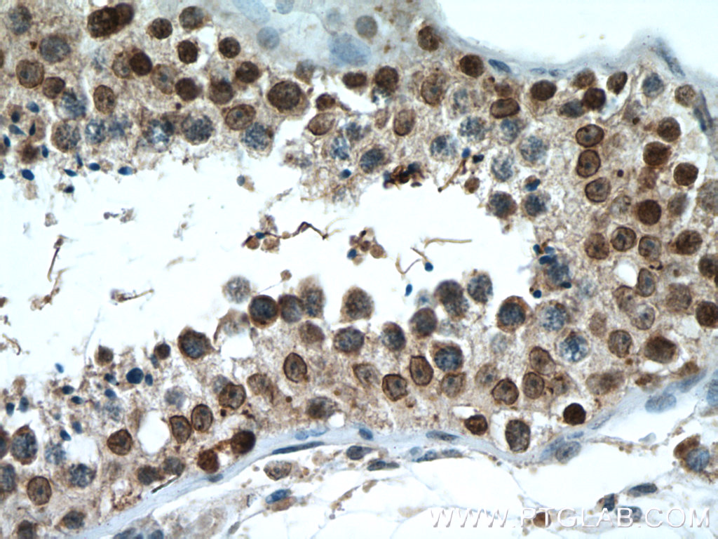 SUMO1 Polyclonal antibody