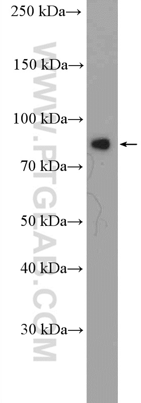 Zyxin Polyclonal antibody
