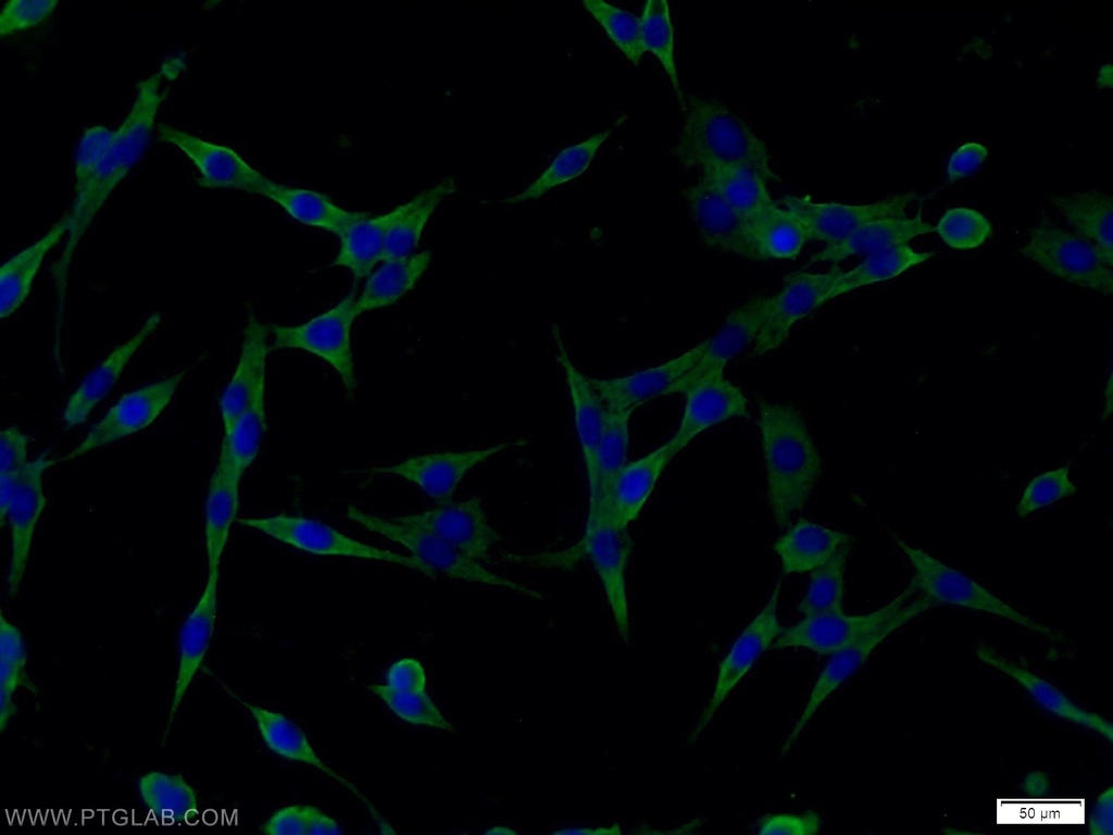 RAB6B Polyclonal antibody