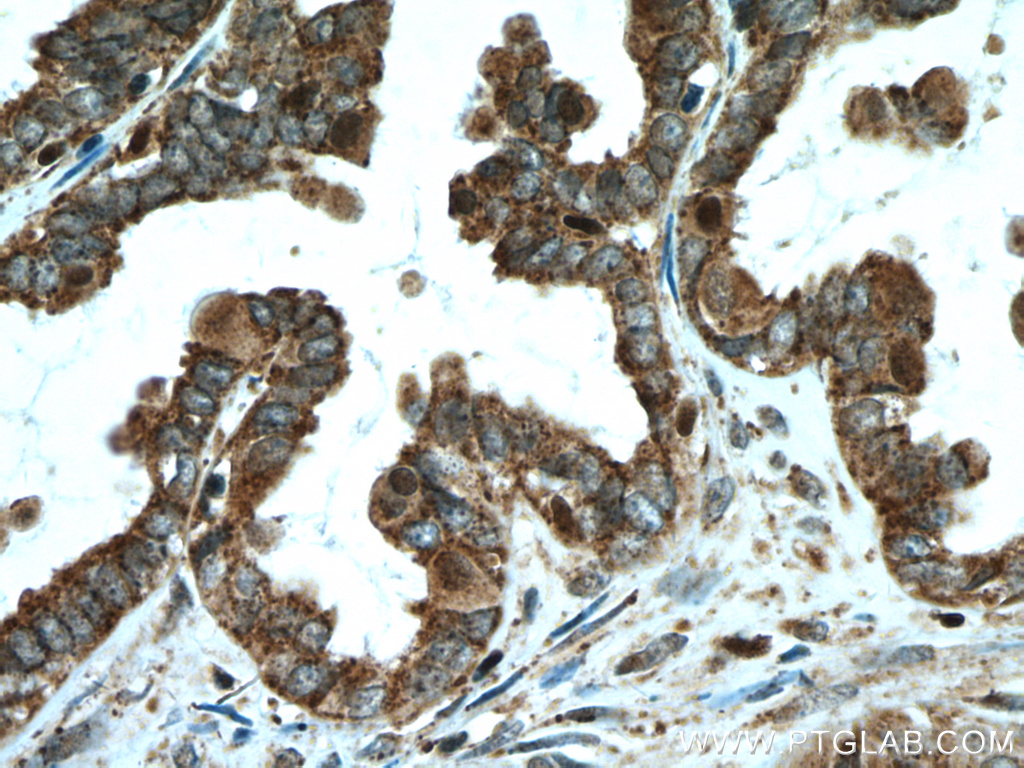 ALDH7A1 Polyclonal antibody