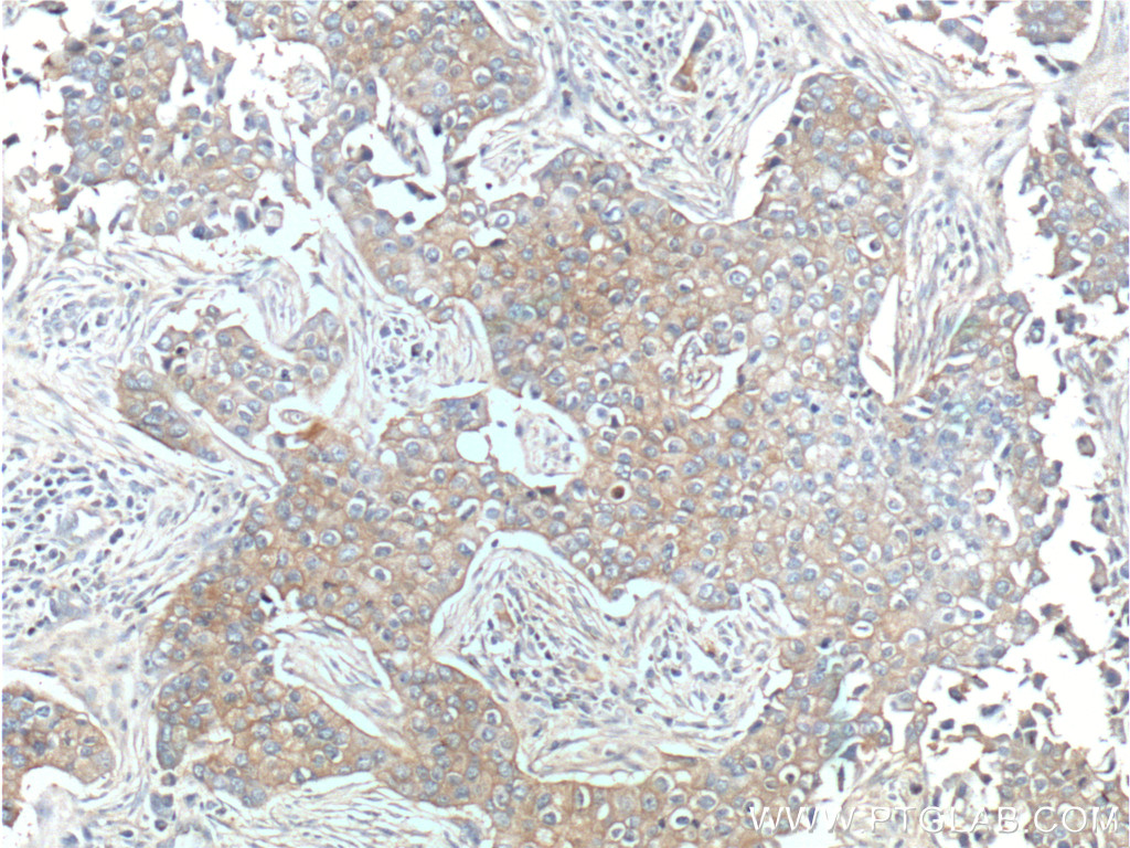 ERBB3 Polyclonal antibody