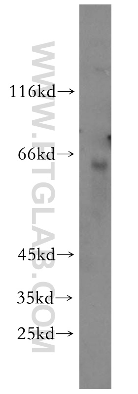 KRBP Polyclonal antibody