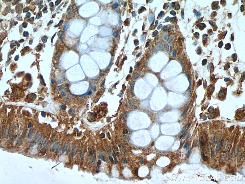 Cytohesin 2 Polyclonal antibody