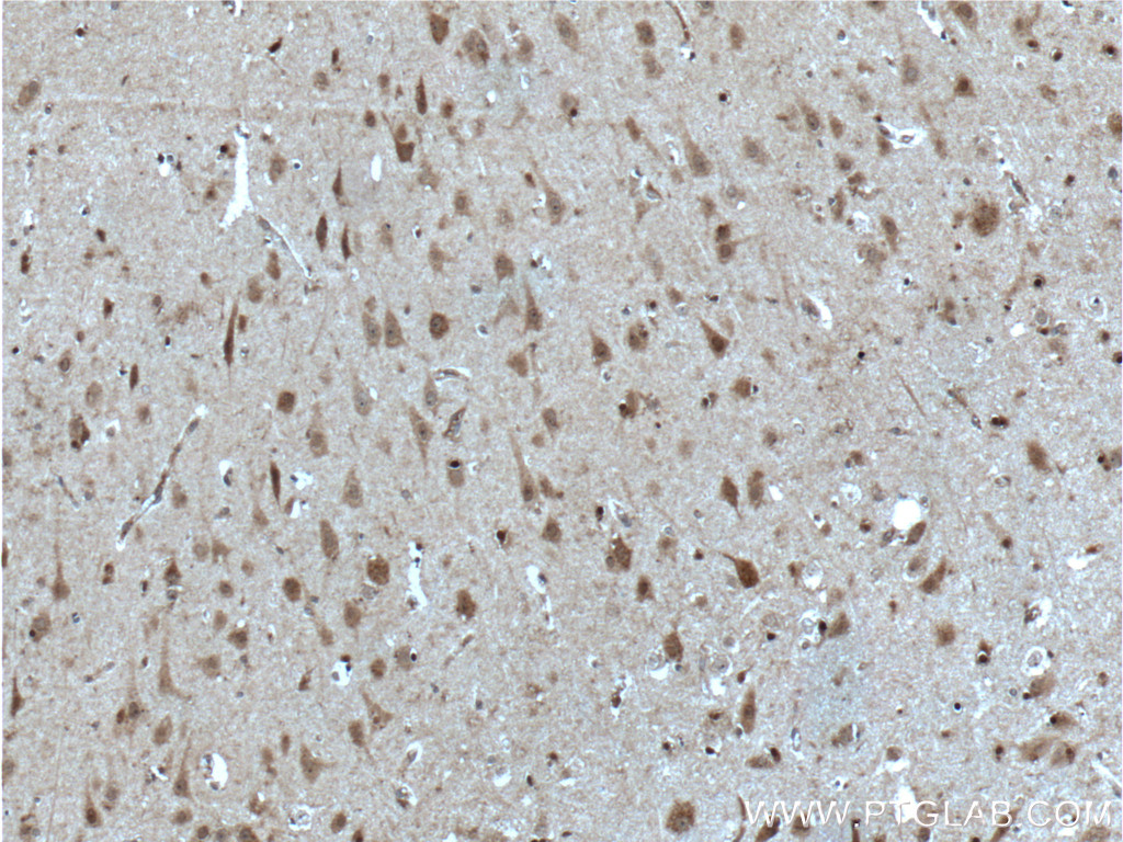 SOX10 Polyclonal antibody