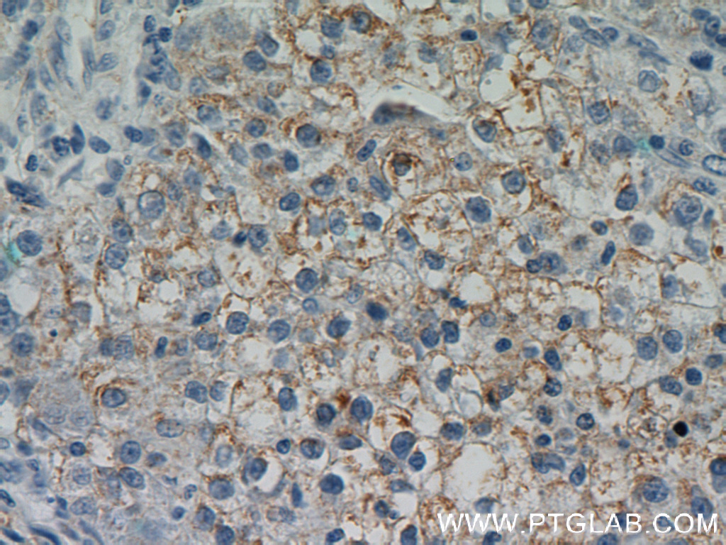 DSE Polyclonal antibody