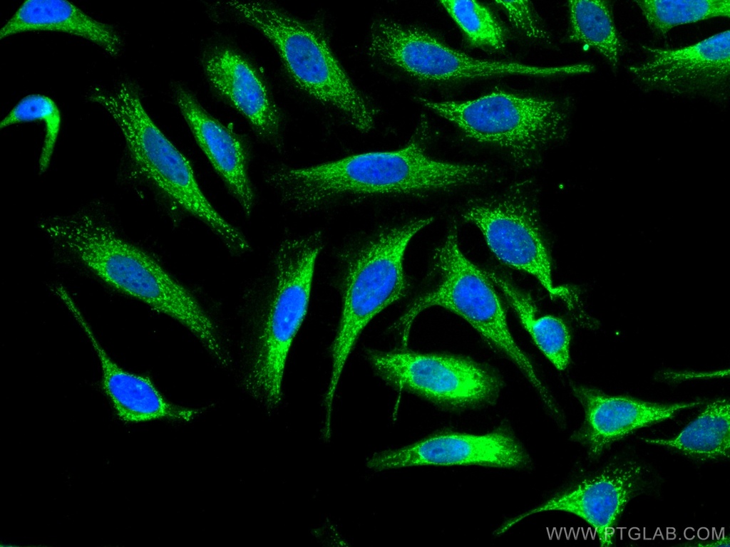 Annexin A11 Polyclonal antibody