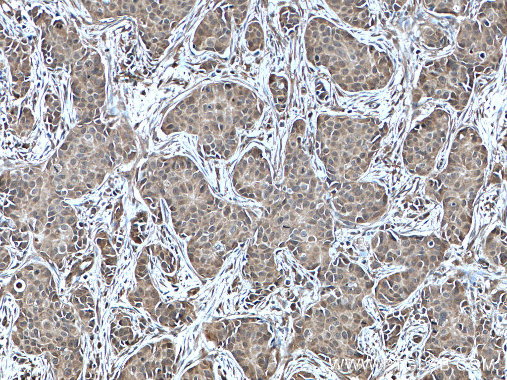 NUDT2 Polyclonal antibody