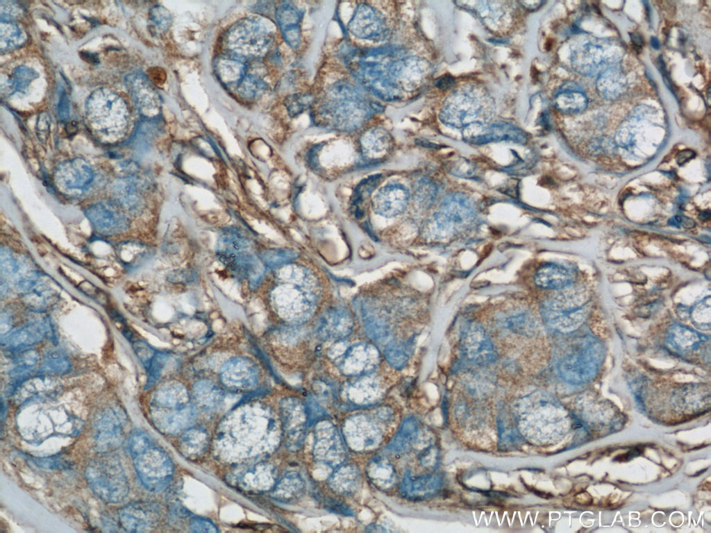 RhoGDI Polyclonal antibody