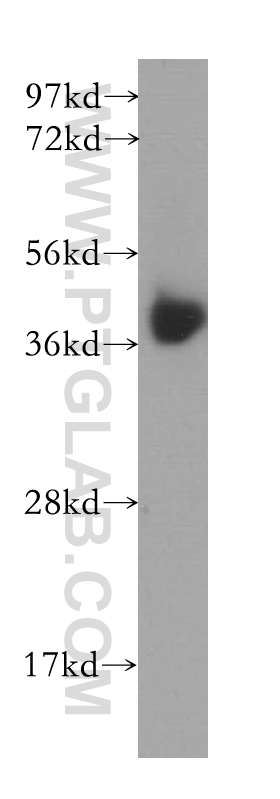 B4GALT7 Polyclonal antibody