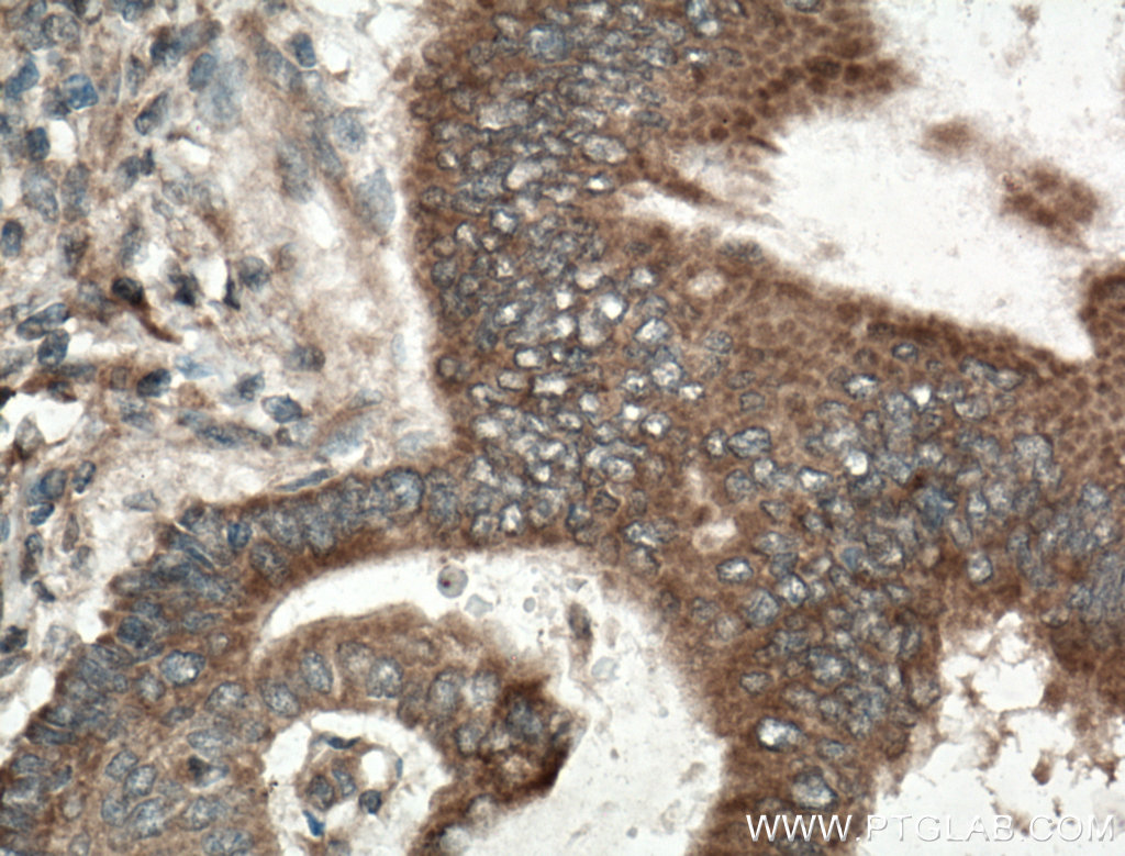 RKIP Polyclonal antibody