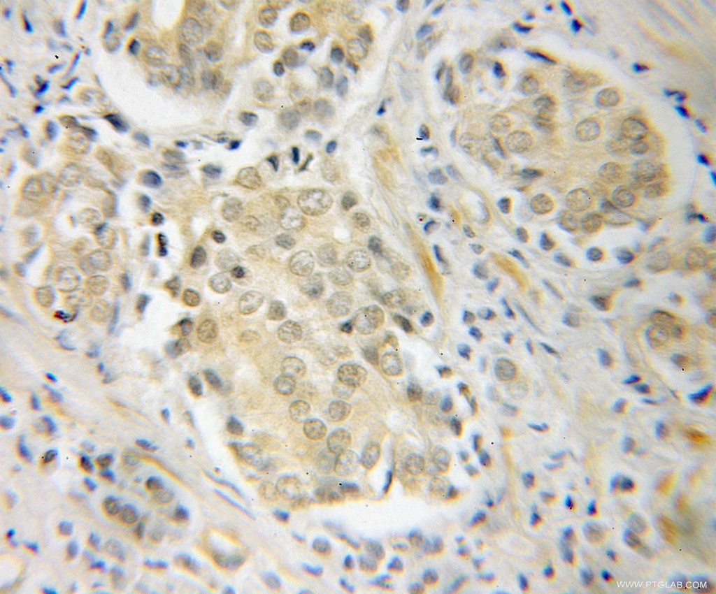 POT1 Polyclonal antibody