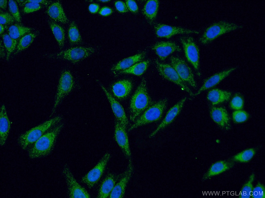 SDHB Polyclonal antibody