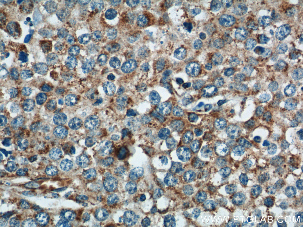 NDUFV1 Polyclonal antibody