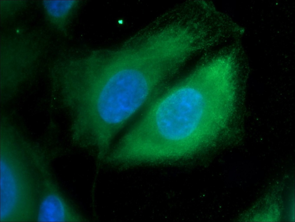 Cathepsin K Polyclonal antibody