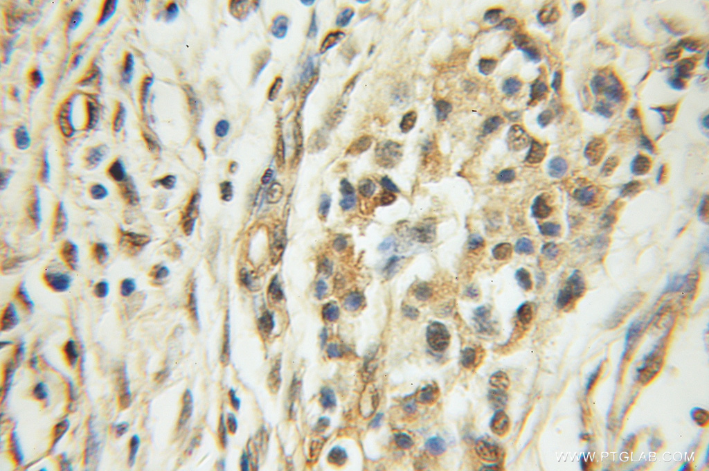 ARHGEF18 Polyclonal antibody