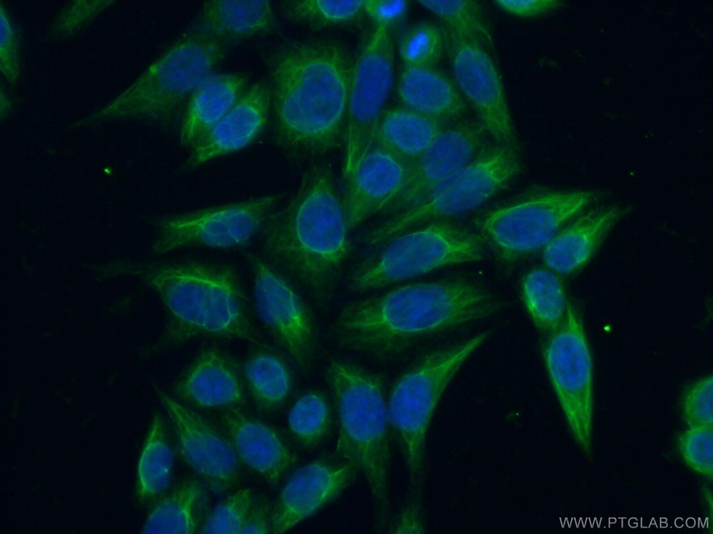 AASDHPPT Polyclonal antibody