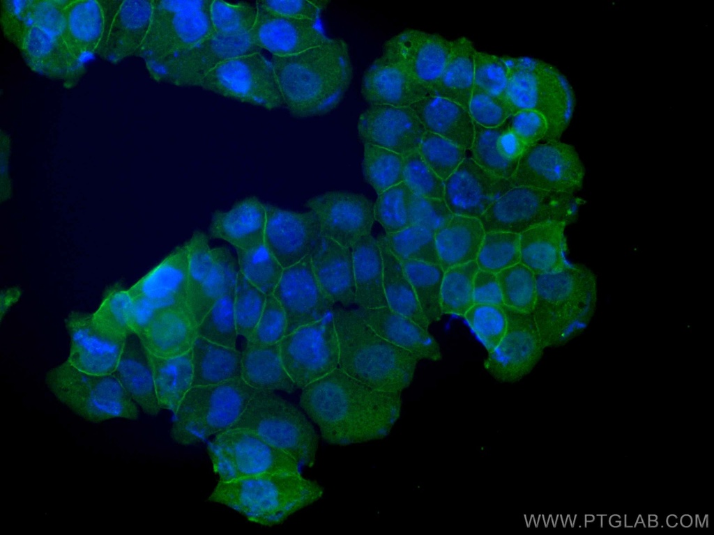 Annexin A2 Polyclonal antibody