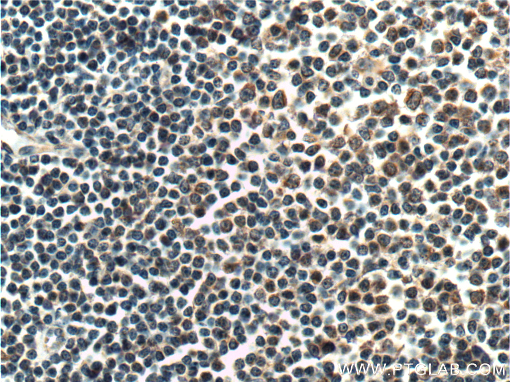 HAX1 Polyclonal antibody