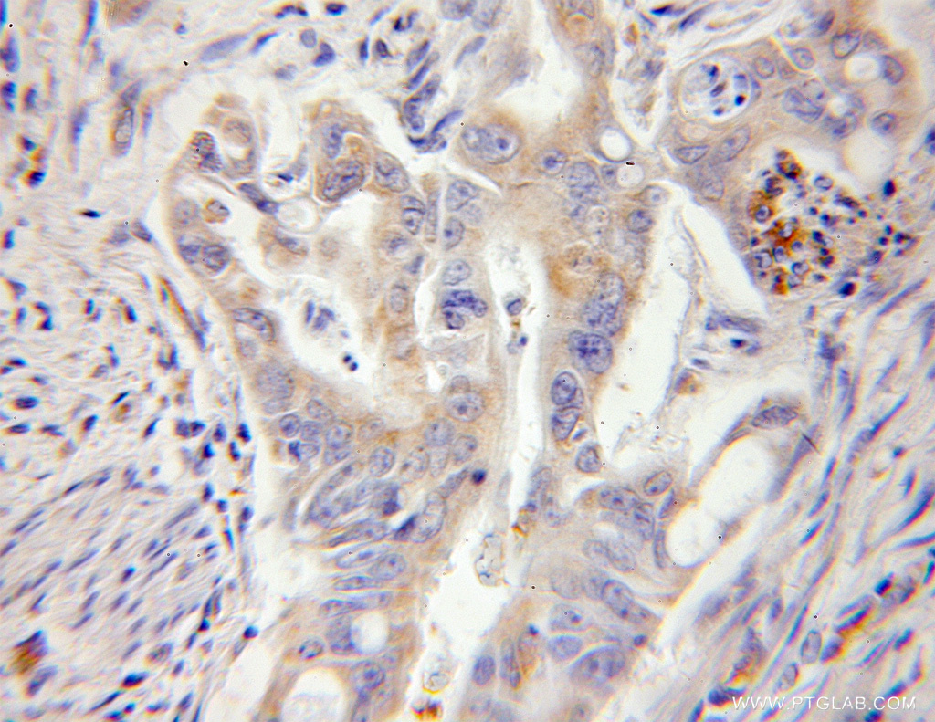 RPL13 Polyclonal antibody