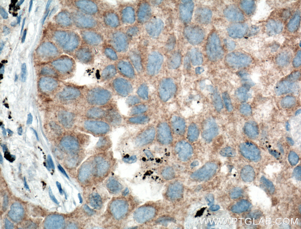 RNF156 Polyclonal antibody