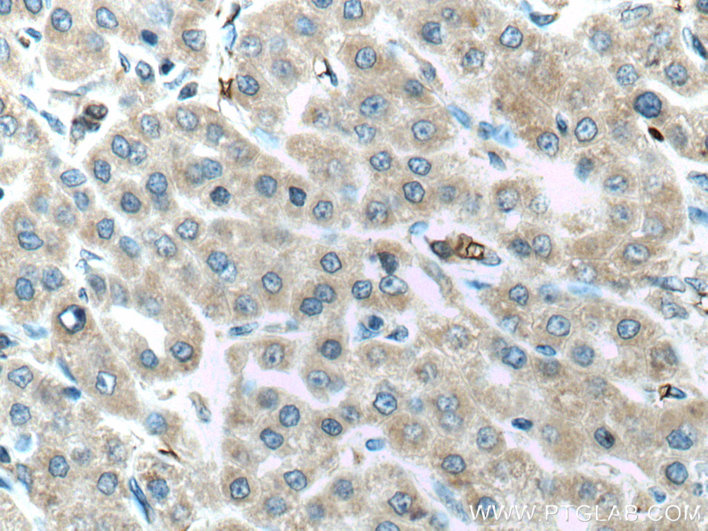 ALR Polyclonal antibody