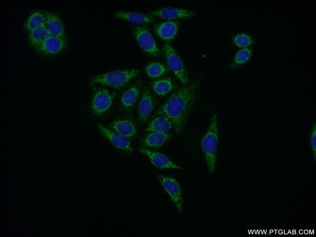 EIF2B3 Polyclonal antibody