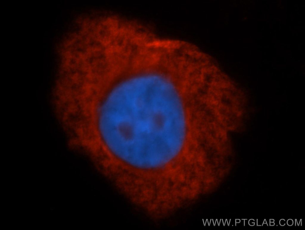 ribosomal protein L4 Polyclonal antibody