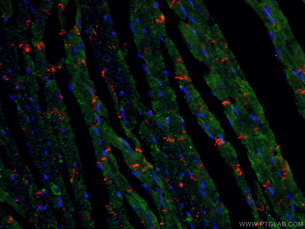 Alpha Actinin Polyclonal antibody